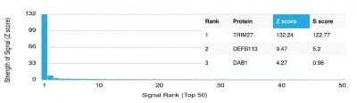 Protein Array: TRIM27 Antibody (PCRP-TRIM27-1B3)Azide and BSA Free [NBP3-08579]