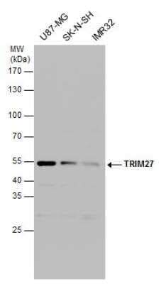 Western Blot: TRIM27 Antibody [NBP2-20711]