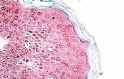 Immunohistochemistry-Paraffin: TRIM29 Antibody [NBP1-52000]