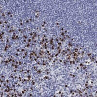 Immunohistochemistry-Paraffin: TRIM29 Antibody [NBP3-17646]
