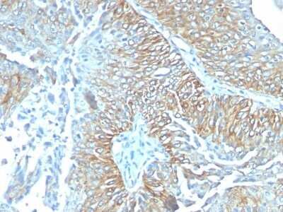 Immunohistochemistry-Paraffin: TRIM29 Antibody (TRIM29/1041) - Azide and BSA Free [NBP2-47808]