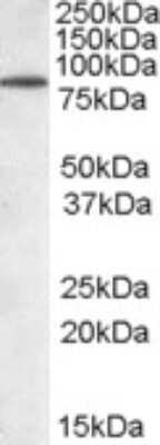 Western Blot: TRIM3/BERP Antibody [NB100-2494]