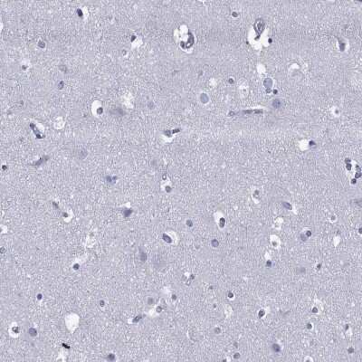 Immunohistochemistry-Paraffin: TRIM31 Antibody [NBP3-17068]