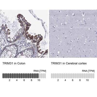 Immunohistochemistry-Paraffin: TRIM31 Antibody [NBP3-17068]
