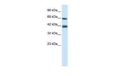 Western Blot: TRIM31 Antibody [NBP2-88468]