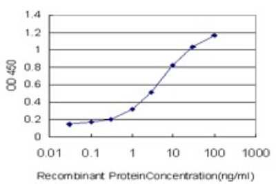 ELISA: TRIM32 Antibody (2E5) [H00022954-M09]