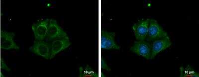 Immunocytochemistry/ Immunofluorescence: TRIM32 Antibody [NBP1-33737]