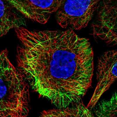 Immunocytochemistry/ Immunofluorescence: TRIM32 Antibody [NBP2-13484]
