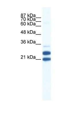 Western Blot: TRIM34 Antibody [NBP1-80050]