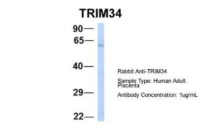 Western Blot: TRIM34 Antibody [NBP1-80359]