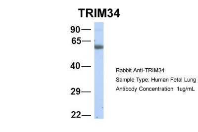 Western Blot: TRIM34 Antibody [NBP1-80359]