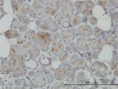 Immunohistochemistry-Paraffin: TRIM35 Antibody (4F7) [H00023087-M02]