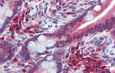 Immunohistochemistry: TRIM35 Antibody [NBP2-88472]