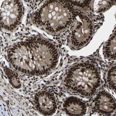 Immunohistochemistry-Paraffin: TRIM35 Antibody [NBP1-81733]