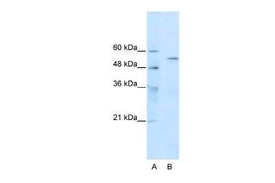 Western Blot: TRIM35 Antibody [NBP2-88473]