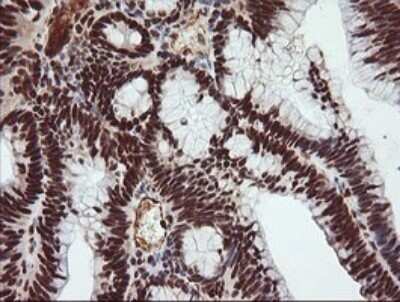 Immunohistochemistry: TRIM38 Antibody (OTI113D3) - Azide and BSA Free [NBP2-74610]