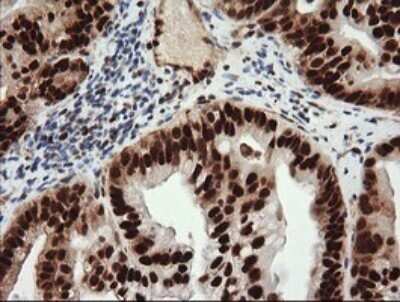 Immunohistochemistry: TRIM38 Antibody (OTI113D3) - Azide and BSA Free [NBP2-74610]