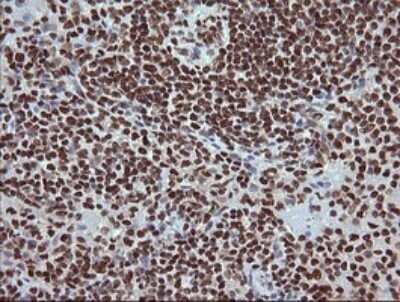 Immunohistochemistry: TRIM38 Antibody (OTI113D3) - Azide and BSA Free [NBP2-74610]