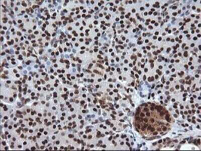 Immunohistochemistry: TRIM38 Antibody (OTI113D3) - Azide and BSA Free [NBP2-74610]