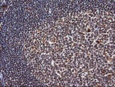 Immunohistochemistry: TRIM38 Antibody (OTI113D3) - Azide and BSA Free [NBP2-74610]