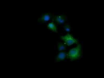 Immunofluorescence: TRIM38 Antibody (OTI113D3) [NBP2-46215]