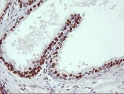 Immunohistochemistry: TRIM38 Antibody (OTI113D3) [NBP2-46215]