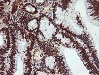 Immunohistochemistry: TRIM38 Antibody (OTI113D3) [NBP2-46215]