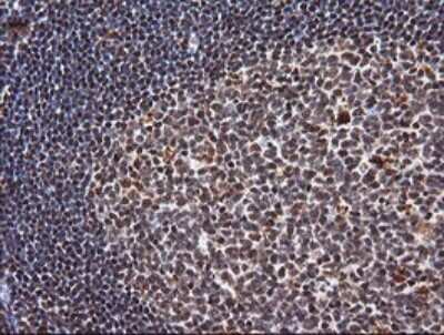Immunohistochemistry: TRIM38 Antibody (OTI113D3) [NBP2-46215]