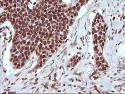 Immunohistochemistry: TRIM38 Antibody (OTI113D3) [NBP2-46215]