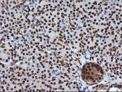 Immunohistochemistry: TRIM38 Antibody (OTI113D3) [NBP2-46215]