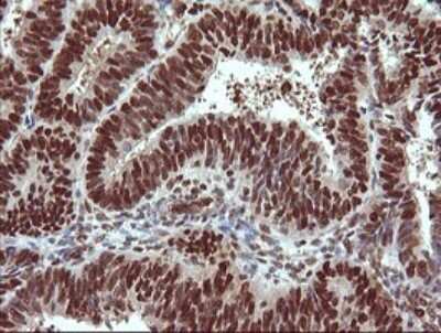 Immunohistochemistry: TRIM38 Antibody (OTI113D3) [NBP2-46215]