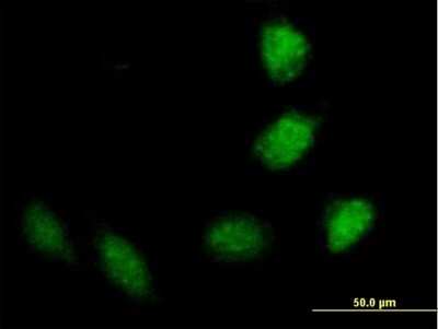 Immunocytochemistry/ Immunofluorescence: TRIM40 Antibody [H00135644-B01P]
