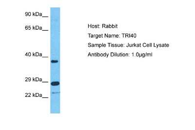 Western Blot: TRIM40 Antibody [NBP2-85986]