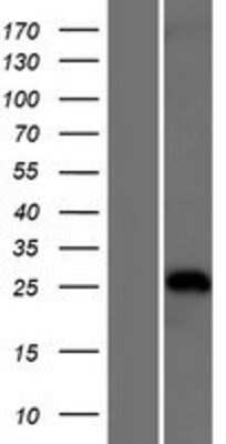 Western Blot: TRIM40 Overexpression Lysate [NBP2-05640]
