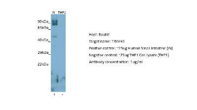 Western Blot: TRIM41 Antibody [NBP2-85989]