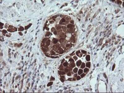 Immunohistochemistry: TRIM44 Antibody (OTI1E10) - Azide and BSA Free [NBP2-74611]