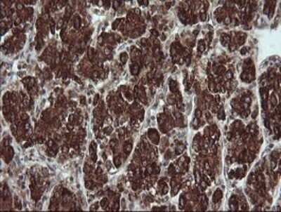Immunohistochemistry: TRIM44 Antibody (OTI1E10) - Azide and BSA Free [NBP2-74611]