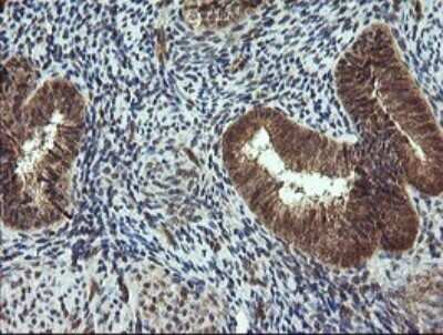 Immunohistochemistry: TRIM44 Antibody (OTI1E10) - Azide and BSA Free [NBP2-74611]