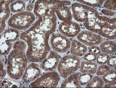 Immunohistochemistry: TRIM44 Antibody (OTI1E10) - Azide and BSA Free [NBP2-74611]