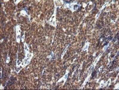 Immunohistochemistry: TRIM44 Antibody (OTI1E10) - Azide and BSA Free [NBP2-74611]