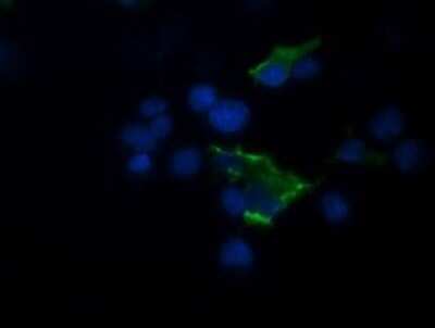 Immunocytochemistry/ Immunofluorescence: TRIM44 Antibody (OTI1E10) [NBP2-46222]