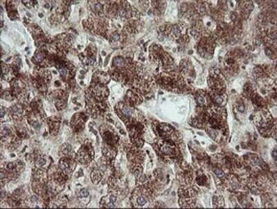 Immunohistochemistry: TRIM44 Antibody (OTI1E10) [NBP2-46222]