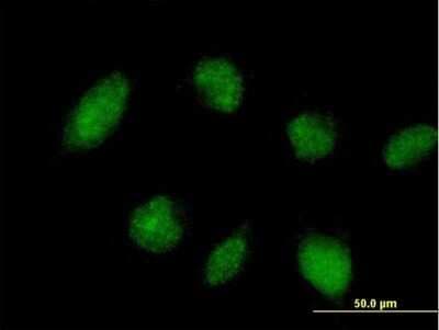 Immunocytochemistry/ Immunofluorescence: TRIM45 Antibody [H00080263-B01P]