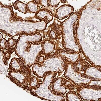 Immunohistochemistry-Paraffin: TRIM45 Antibody [NBP1-82266]