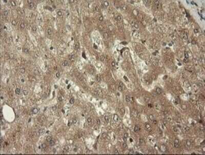 Immunohistochemistry: TRIM45 Antibody (OTI3G3) [NBP2-46223]
