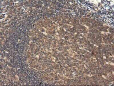Immunohistochemistry: TRIM45 Antibody (OTI3G3) [NBP2-46223]
