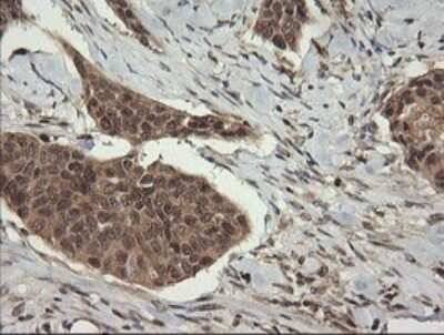 Immunohistochemistry: TRIM45 Antibody (OTI3G3) [NBP2-46223]