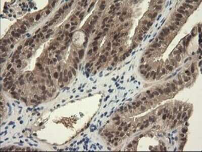 Immunohistochemistry: TRIM45 Antibody (OTI3G3) [NBP2-46223]