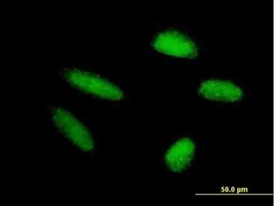 Immunocytochemistry/ Immunofluorescence: TRIM46 Antibody [H00080128-B01P]