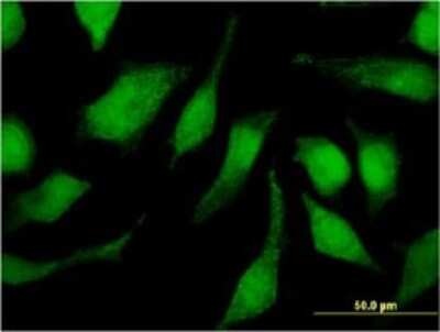 Immunocytochemistry/ Immunofluorescence: TRIM47 Antibody (3C8) [H00091107-M02]